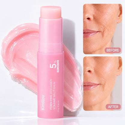🔥LAST DAY 60% OFF Kindijoy Korean Pink CollagenVolume Multi Balm