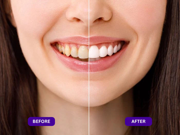 Kindijoy™ Purple Mouth Wash