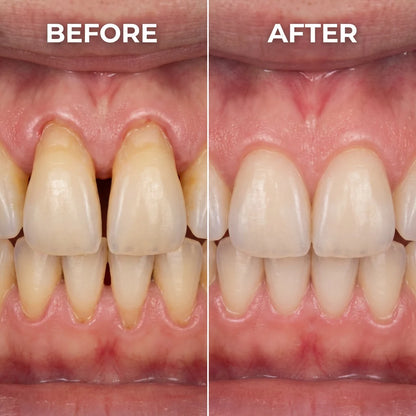 Kindijoy® Gum Protect Repair Gel