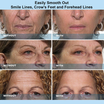 Kindijoy™ Instant Face Temporary Tightener – Instant visible results in 60 seconds