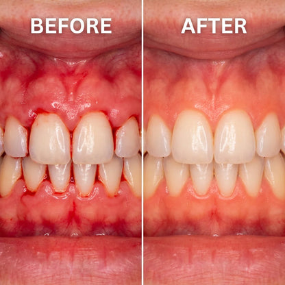 Kindijoy® Gum Protect Repair Gel